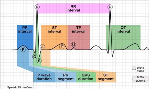 R wave • LITFL • ECG Library Basics .